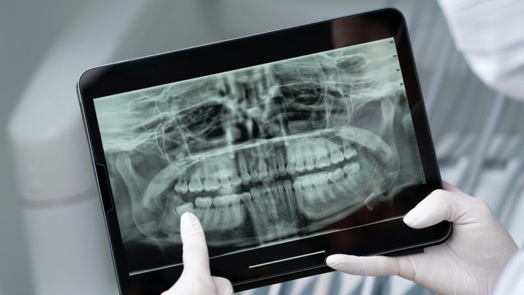 Dental Exams and X-Rays