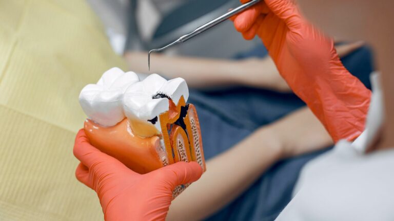 Root Canal Therapy