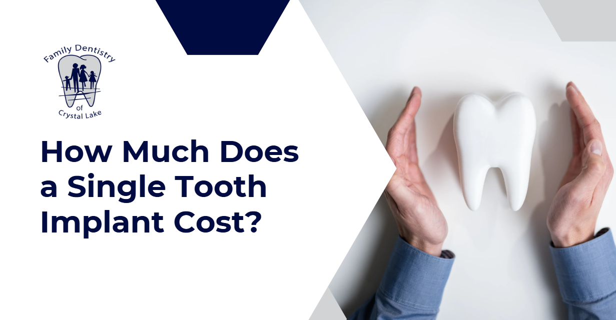 A visual breakdown of the cost of single tooth implants, featuring a large model tooth protected by open hands